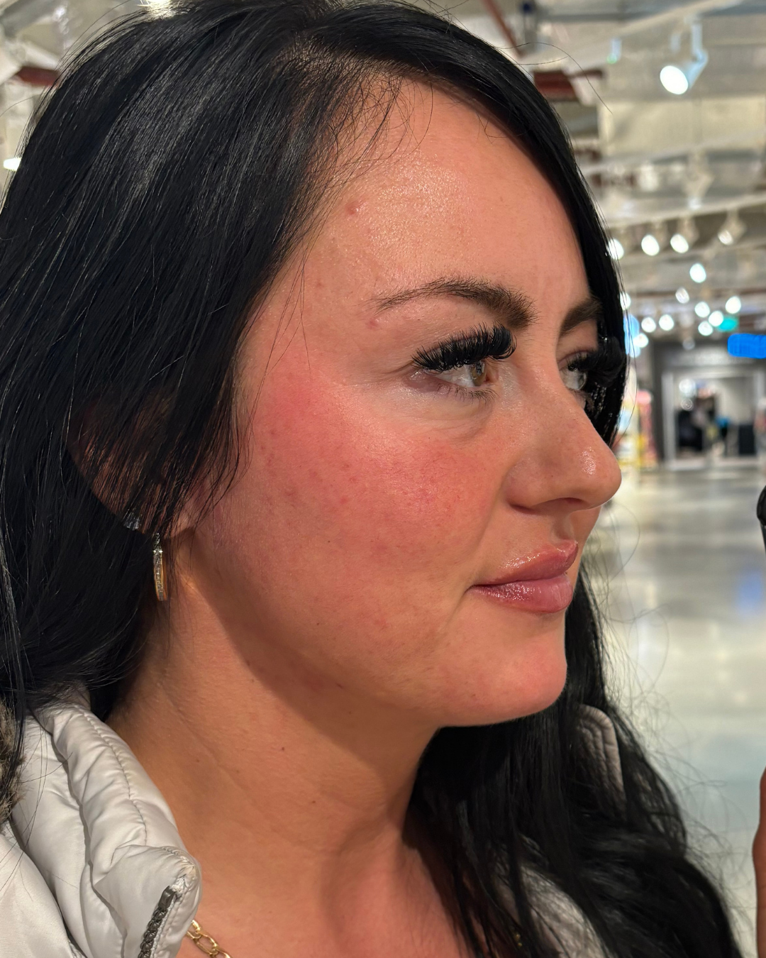 After skincare result