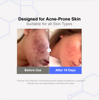 Hypochlorous Acid Cleansing Antibacterial Spray