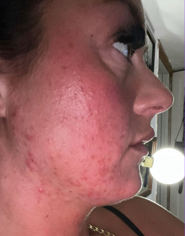 Before skincare result